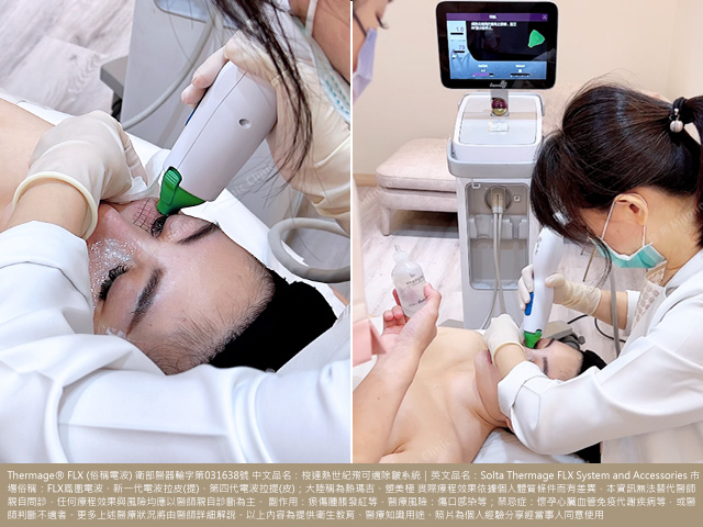 FLX眼周電波術中