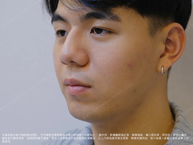 男性常見臉部困擾